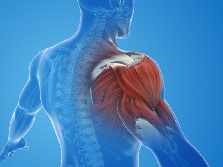 Dr. Pain's Muscle Strain